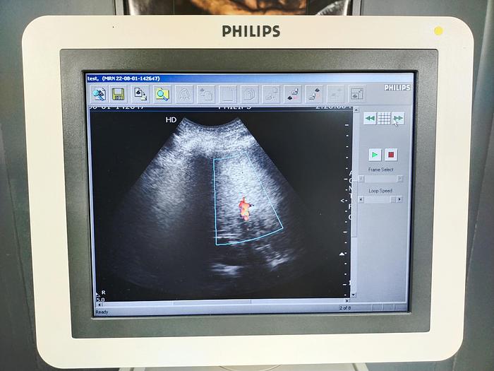 Gebraucht Philips HD7 diagnostik Ultraschallsystem mit DVD Brenner ohne Drucker SW 1.1