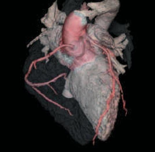 Reformado GE LightSpeed VCT
