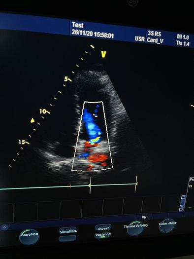 Gebraucht GE Ultraschallsonde Kardio / Sektor 3S-RS