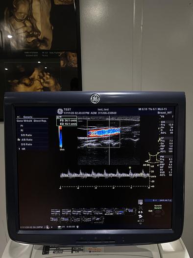 Used GE LOGIQ E9 Ultraschalgerät mit Drucker und 3 Sonden