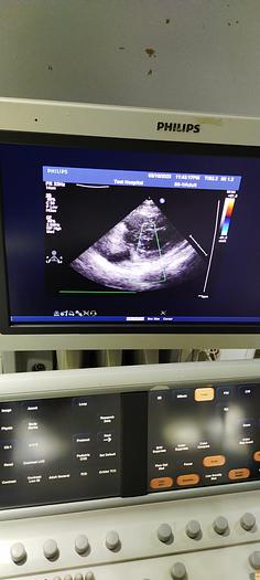 Gebraucht Philips S5-1 Sektor Sonde