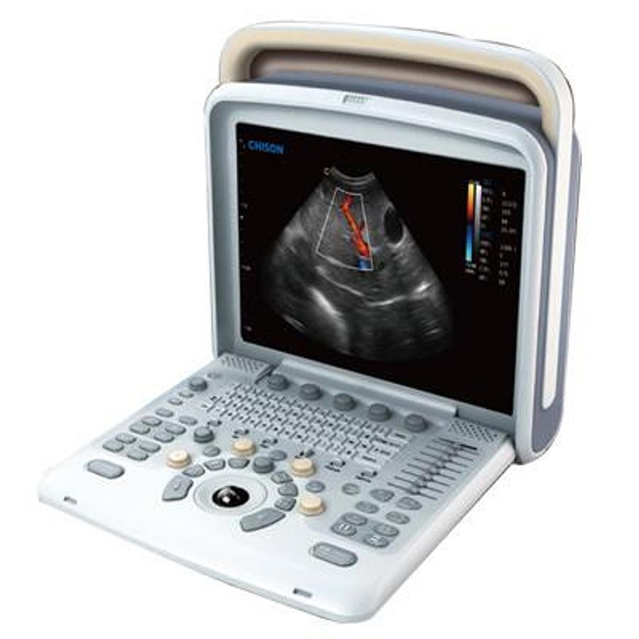 Used Chison Q9 Portable Ultrasound Machine 
