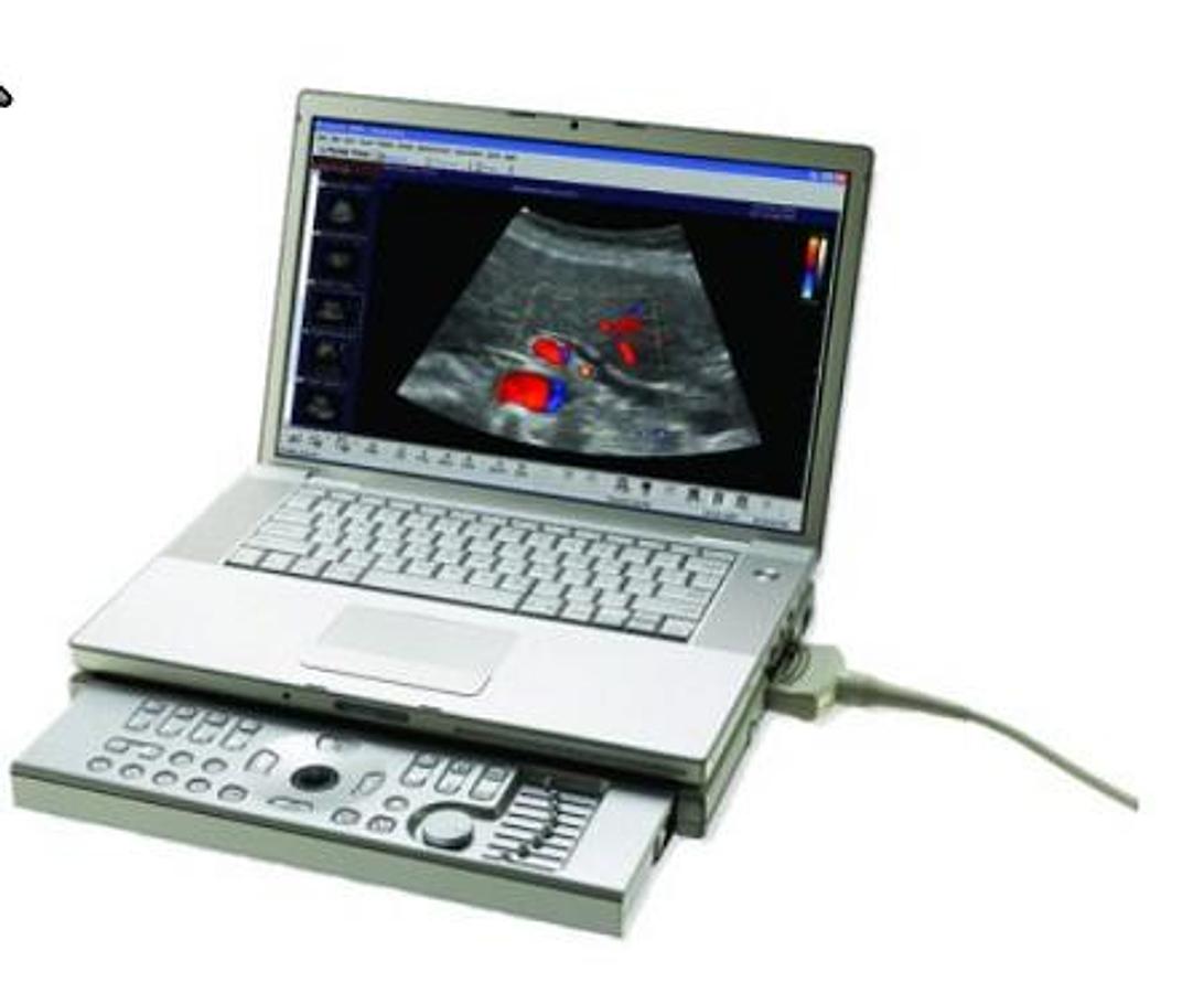 terason-t3000.png