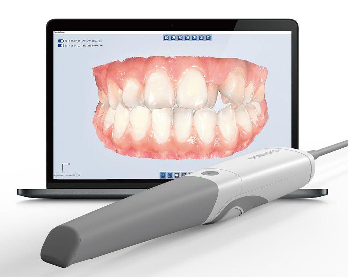 condor-dental-aoralscan-3.jpg