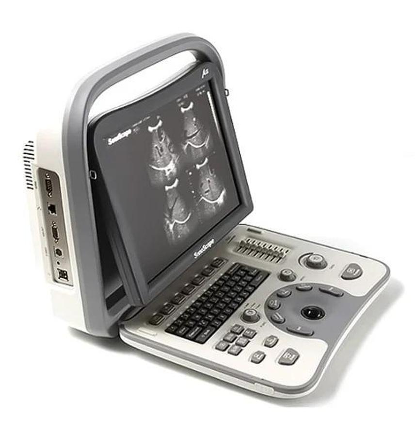 Used Sonoscape A6 Portable Ultrasound System
