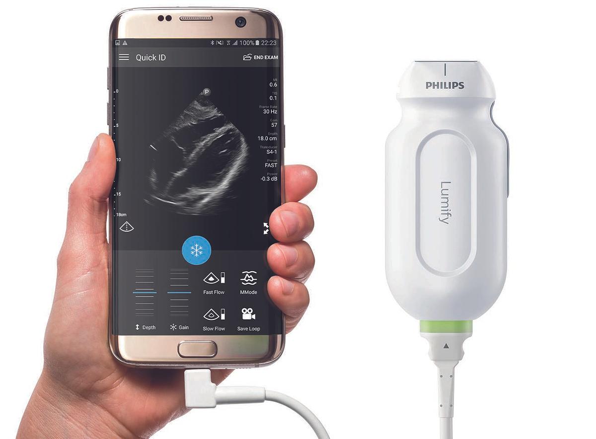 philips-lumify.jpg