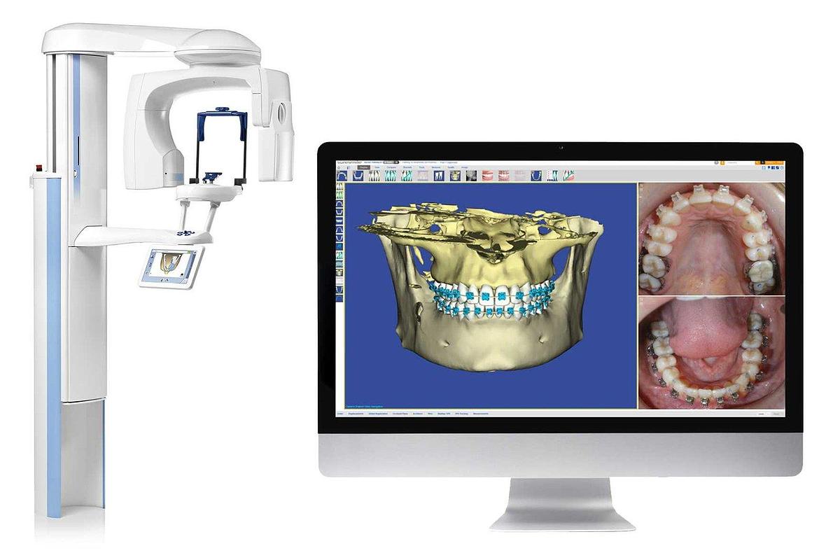 planmeca-promax-3d-s.jpg