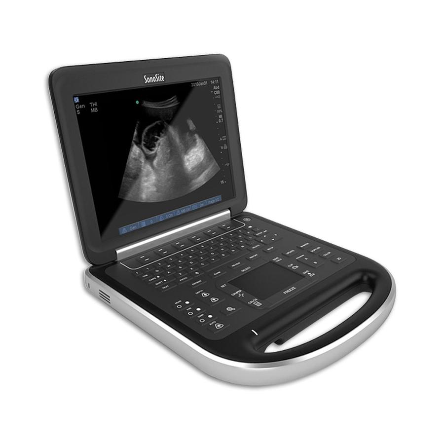 Used Fujifilm Sonosite Edge Portable Ultrasound System