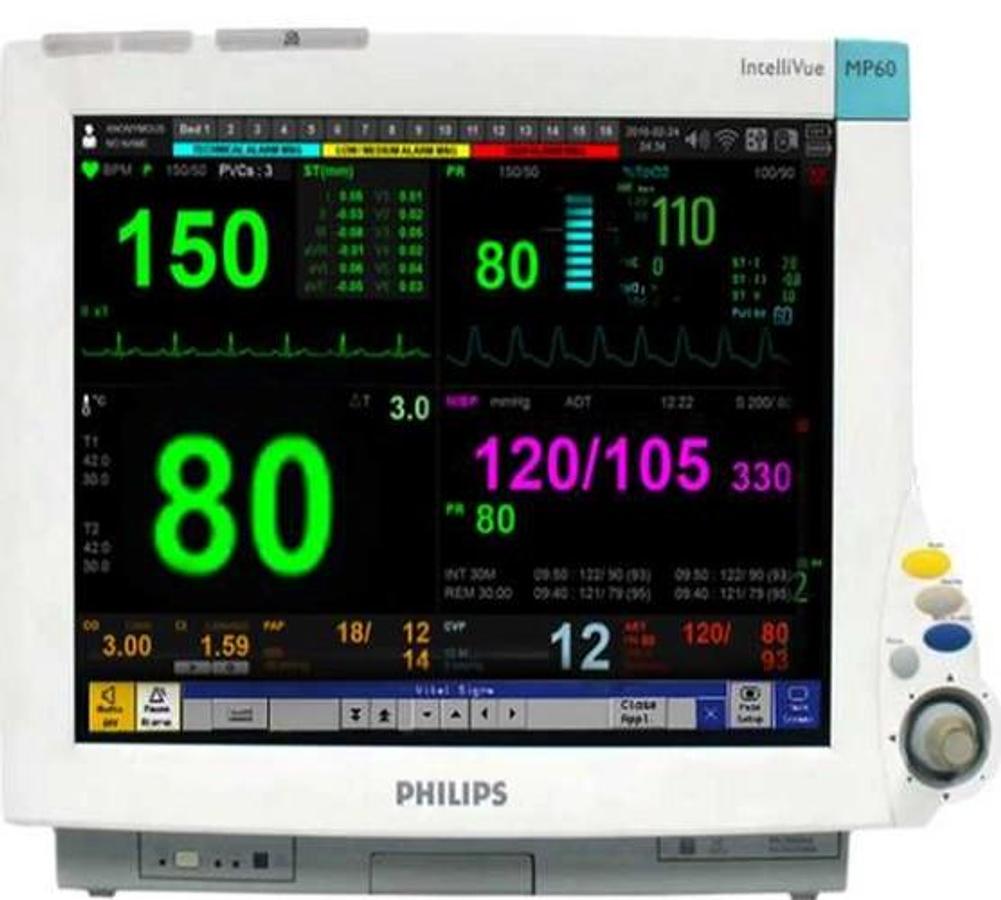 philips-intellivue-mp60.webp
