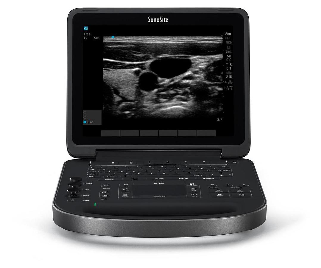Used Fujifilm SonoSite Edge II Portable Ultrasound System