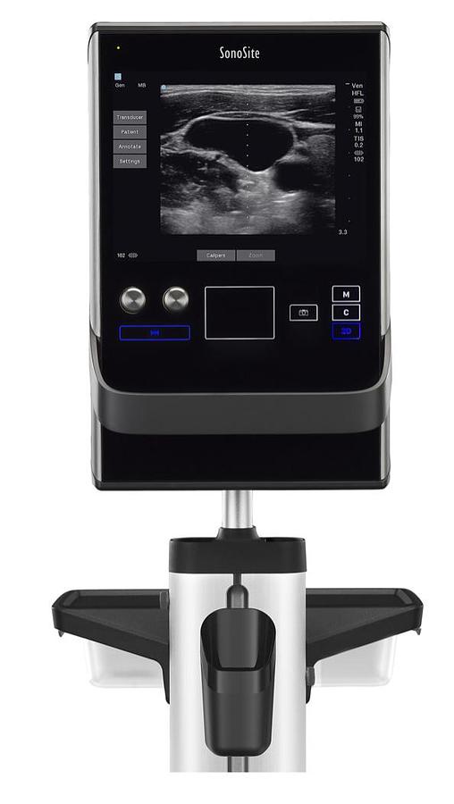 sonosite-sii.png