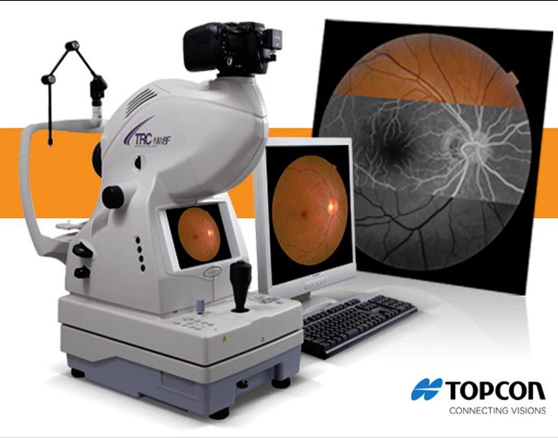 topcon-trc-nw8f.png