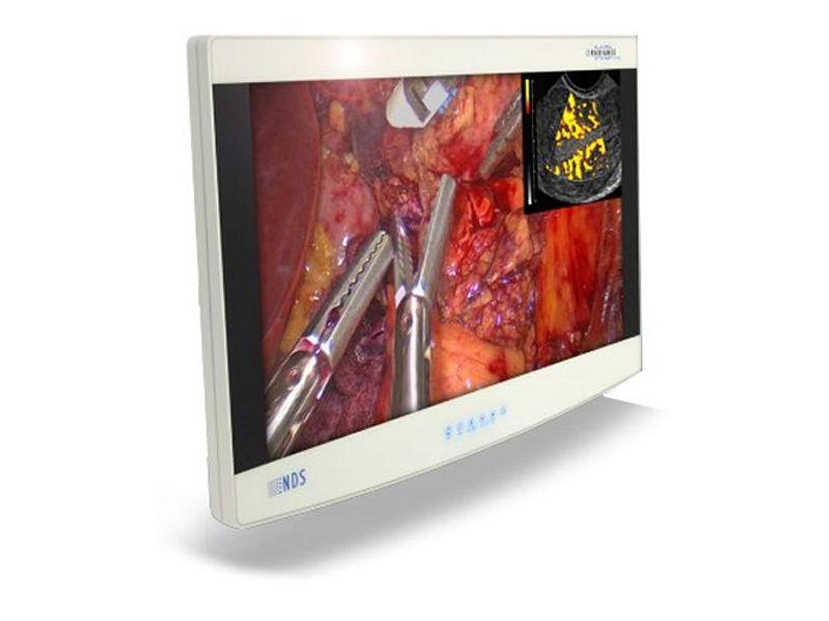 nds-surgical-imaging-radiance-light-source.jpg