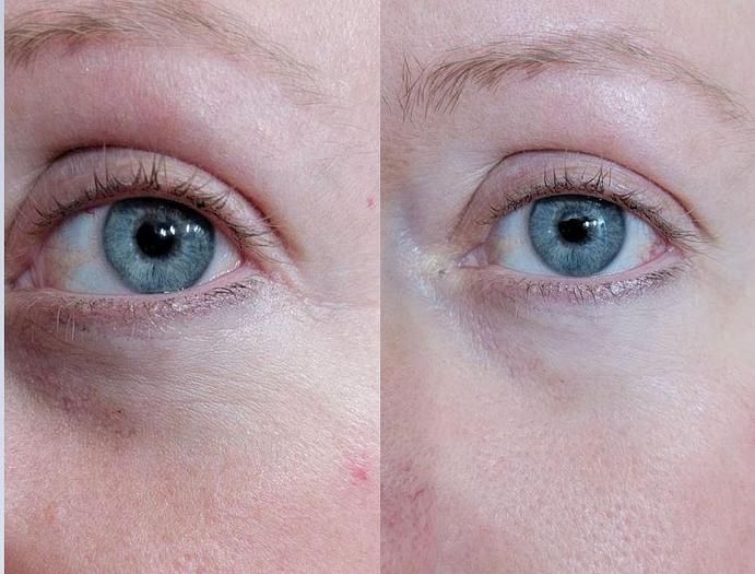 Reflections Pro Formula - Smooth 2 in 1 Instant Lift and Long Term Results