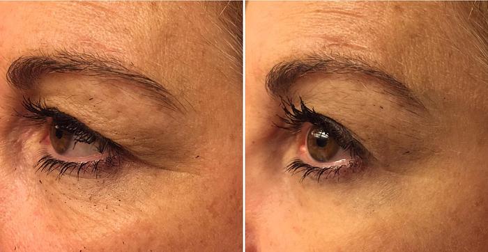 Reflections Pro Formula - Smooth 2 in 1 Instant Lift and Long Term Results