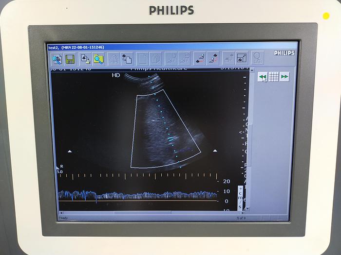 Gebraucht Philips HD7 XE Diagnostik Ultraschallsystem mit konvex Sonde, Drucker und DVD Brenner