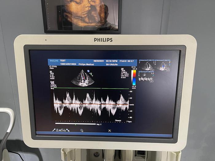 Gebraucht Philips IE33 Ultraschallgerät mit 4 Ultraschallsonden, Sony Drucker
