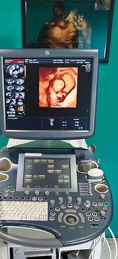 Gebraucht GE Voluson E6 Ultraschallgerät inkl. 3 Sonden Ultrasound 4D