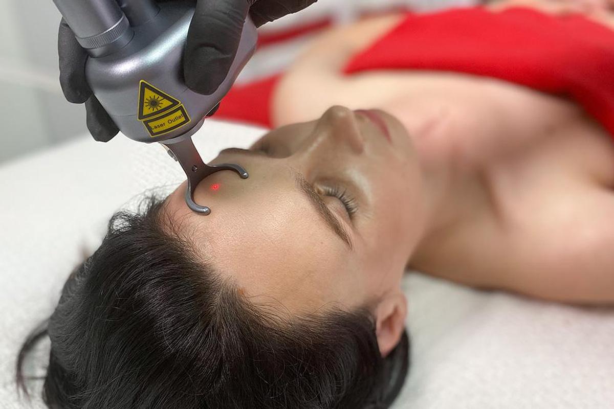 SkinGlow CO2 Fractional