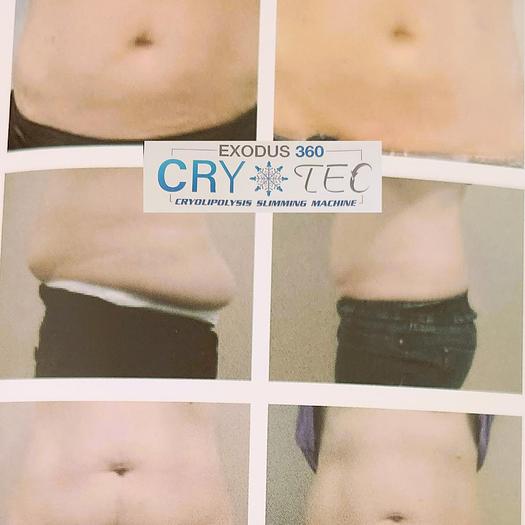 Used Cry-Tec Fat Freezing Machine with 4 handpieces No Cards Needed