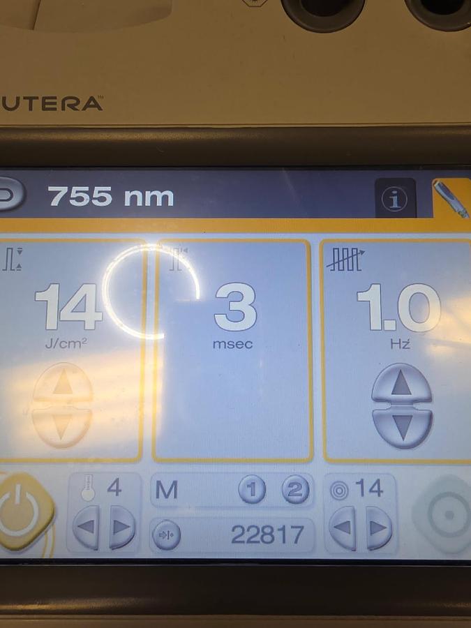 Used Cutera Excel HR Laser