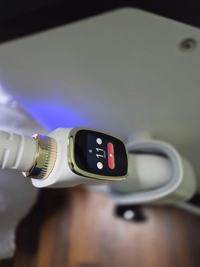 Trinity Plus Ai Driven Laser Hair Removal