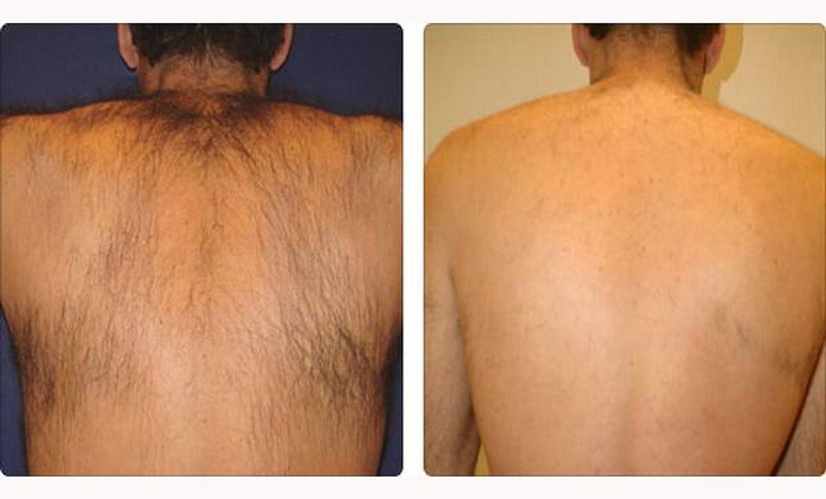 Used 2020 Exo Platinum Diode