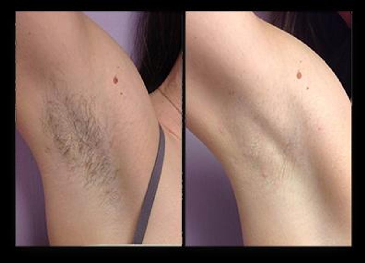 Used 2020 Exo Platinum Diode