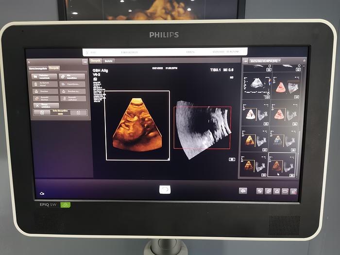 Gebraucht Philips EPIQ 5W Elite X Matrix Heart Model Diagnostik Ultraschall-System SW 7.0.3 mit drei Sonden und Drücker