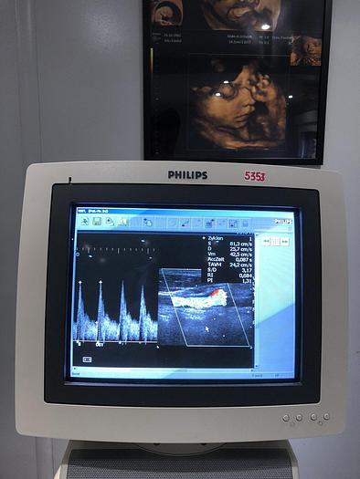 Gebraucht Philips HD11 Ultraschallgerät mit 3x Sonden, Sony Drucker UP-D895MD