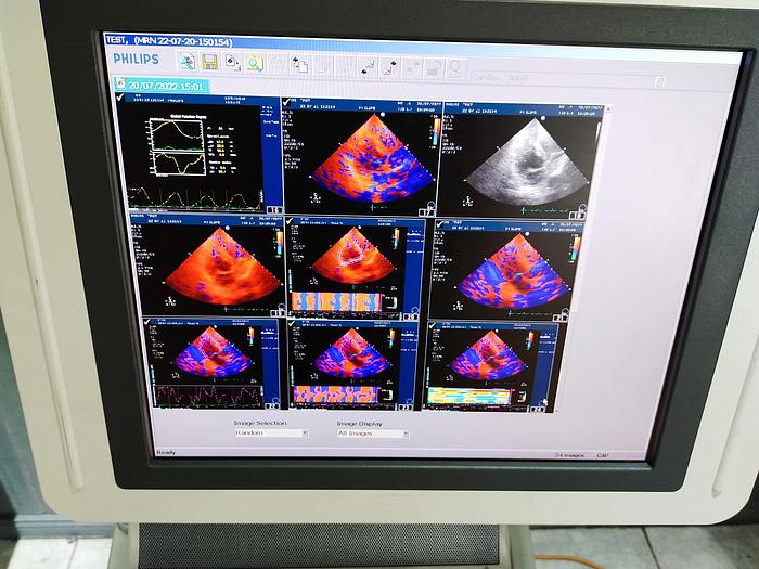 Gebraucht Philips HD11XE Ultraschallgerät mit drei Sonden, Drucker und Video Kassette Recorder S/V 2.0.8