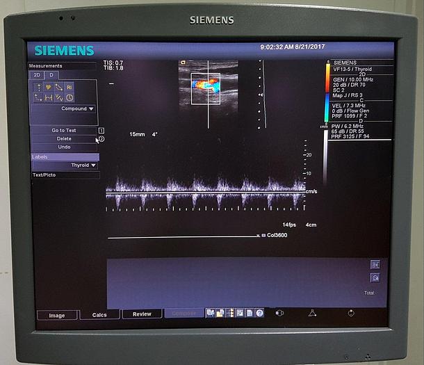 Gebraucht Siemens Acuson Antares Premium Edition 10032746 Ultraschallgerät Flachbildmonitor 5 Sonden Drucker