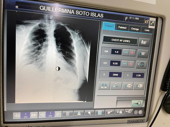 Reformado Rayos X rodable FujiFilm FCR GO