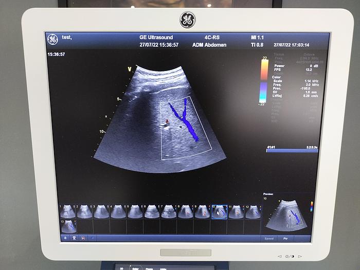Gebraucht GE Vivid T8 Ultraschallsystem für Herz- und Gefäß-Ultraschall mit Kardio Sonde SW: R1.0.7
