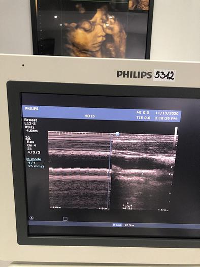 Gebraucht Philips HD15 Ultraschallgerät mit 3 Sonden und Drucker