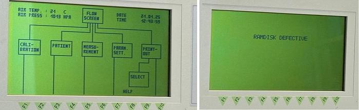 Used JAEGER Spirometr Flowscreen