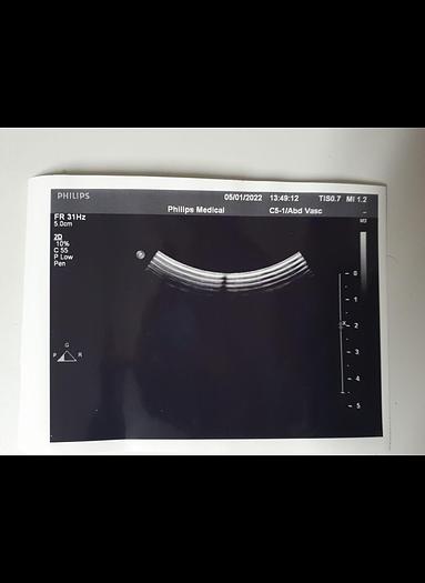 Gebraucht Ultraschall Sonde