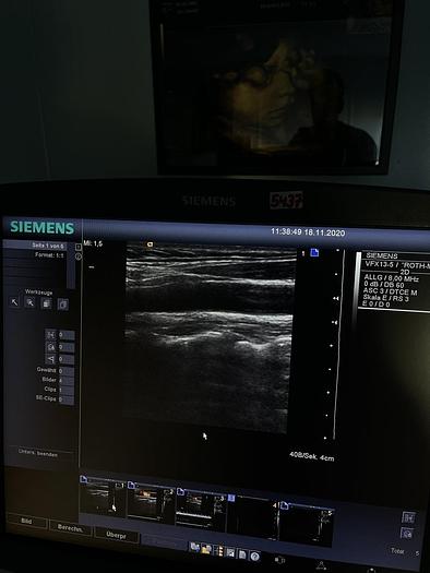 Gebraucht Siemens Acuson Antares Ultrschallsystem mit 3x Sonden, Mitsubishi P93D Drucker, DVD Recorder