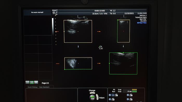 Gebraucht GE Voluson E8 Ultraschalgerät