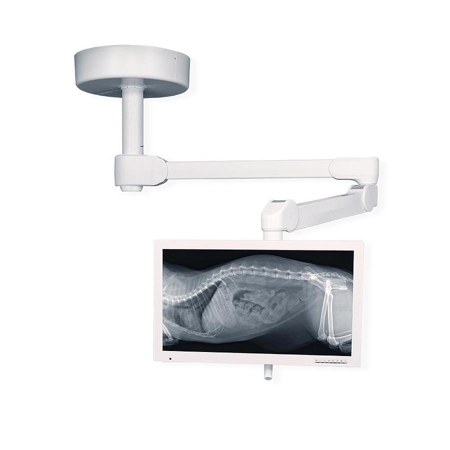 Nuvo Vu 160 LED Surgical Light