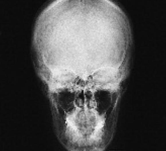 Usado 2001 General Electric (GE) Proteus Xr/a