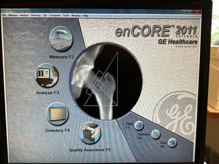 Used 2011 GE Lunar Prodigy Advance