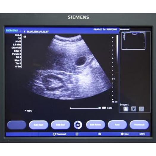 D'occasion ECHOGRAPHE SIEMENS ACUSON X300 AVEC 4 SONDES ET ECRAN PLAT