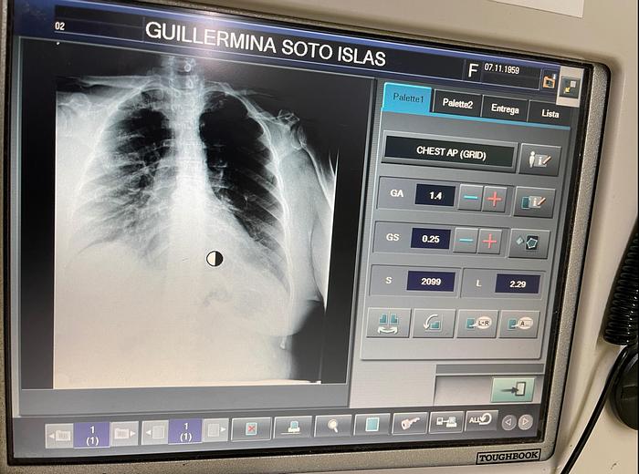 Used Fuji-GO 2 Portable X-ray