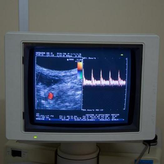 D'occasion ECHOGRAPHE DOPPLER HITACHI ODYSSEE AVEC 3 SONDES