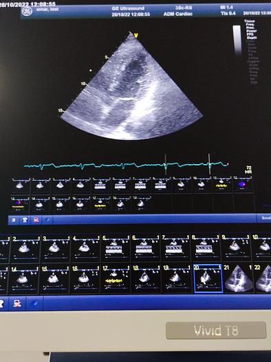 Gebraucht GE Vivid T8