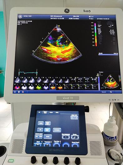 Gebraucht GE Vivid T8 Ultraschallsystem für Herz- und Gefäß-Ultraschall mit Kardio Sonde SW: R1.0.7