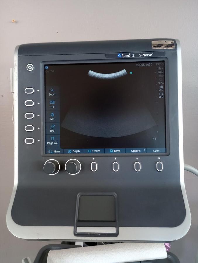 Used 2011 Sonosite S-Nerve Ultrasound System w/ C60×/5-2 MHz Transducer