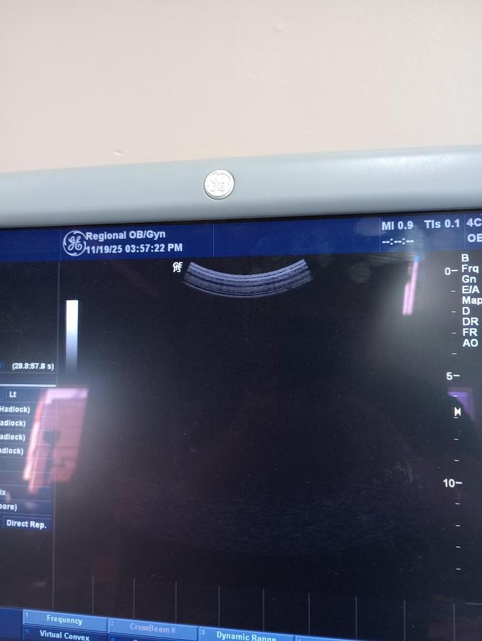 Used GE LOGIQ P5 Ultrasound plus 1 Probe - Excellent Condition