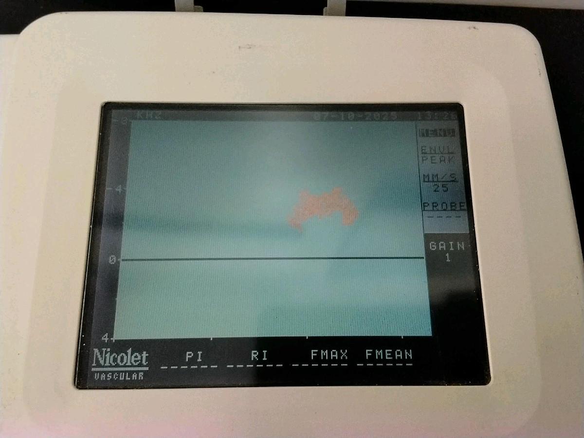Used Nicolet Vascular VERSALAB  LE WITH PRINTER
